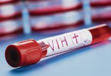 Valparaíso: Anuncian cobertura de test rápidos de VIH en red primaria de la región