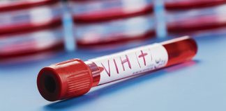 Conmemoración del Día Mundial del SIDA