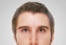 La exposición excesiva al sol empeora los cuadros de acné