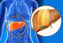Hígado graso: en qué consiste esta silenciosa enfermedad
