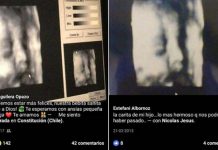 DENUNCIAN QUE MÉDICO HABRÍA ENGAÑADO A PACIENTES EMBARAZADAS CON LA MISMA ECOGRAFÍA