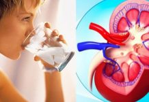 Cálculos renales: las molestas piedras que causan estragos en los riñones