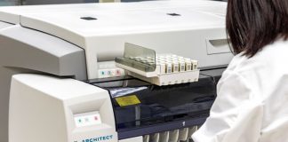 Abbott anuncia la disponibilidad de su prueba de anticuerpos COVID-19 en Chile, para uso en laboratorios