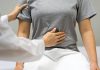 Prevención es crucial para evitar el cáncer de colon