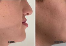 Cirugía Ortognática: una solución que mejora la apariencia, la autoestima y la calidad de vida de los pacientes.