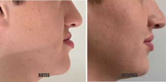 Cirugía Ortognática: una solución que mejora la apariencia, la autoestima y la calidad de vida de los pacientes.