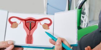 DIU de Cobre: El anticonceptivo de emergencia más efectivo y muy desconocido en el país